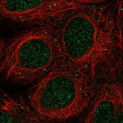 GLB1L2 Antibody, Novus Biologicals 0.1mL; Unlabeled:Antibodies, Polyclonal